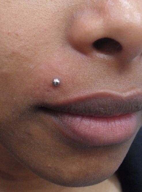 LABIO-LATERAL